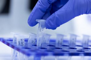 Labaqua, acreditada por ENAC para detectar el Sars-Cov-2 por PCR en tiempo real en aguas residuales