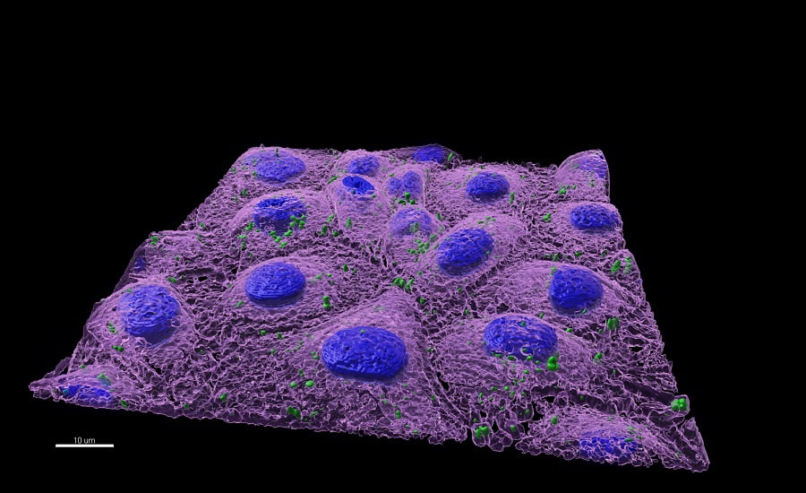 nanoplásticos en una célula de pez cebra