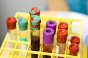 Encuentra plástico en la sangre humana
