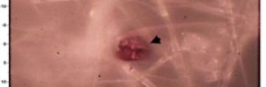 Encuentran microplásticos en placentas de madres hawaianas