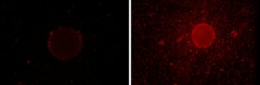 Una bacteria produce un ‘detergente orgánico’ para degradar el petróleo