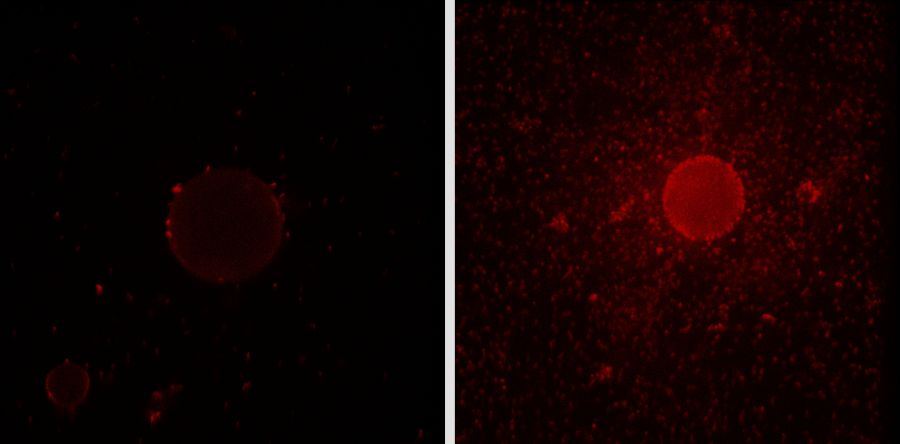 Un bacteria capaz de degradar el petróleo