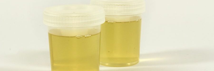 Proponen usar orina en lugar de agua para producir hidrógeno verde