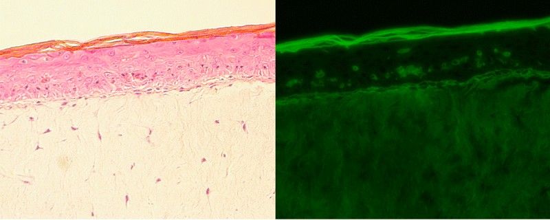 Compuestos fotoprotectores y antiinflamatorios a partir de residuos agrícolas