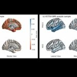 La exposición a la contaminación atmosférica se asocia con cambios cerebrales en regiones vulnerables al alzhéimer